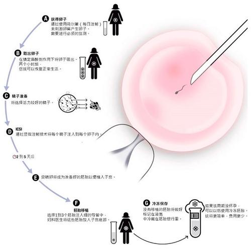 供精试管的全部流程_供精试管:从取卵到移植的全流程解析