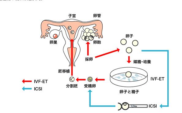 台湾供卵试管(台湾供卵试管:新选择,新希望)