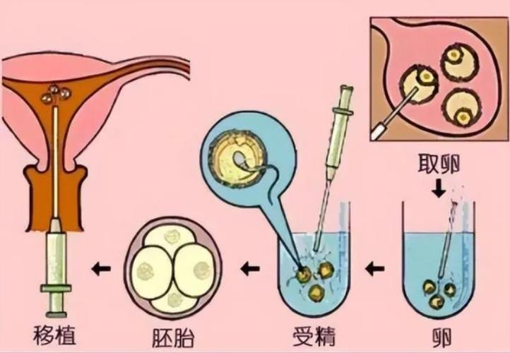 江西南昌哪里有做供卵试管(南昌哪里可以做供卵试管？)